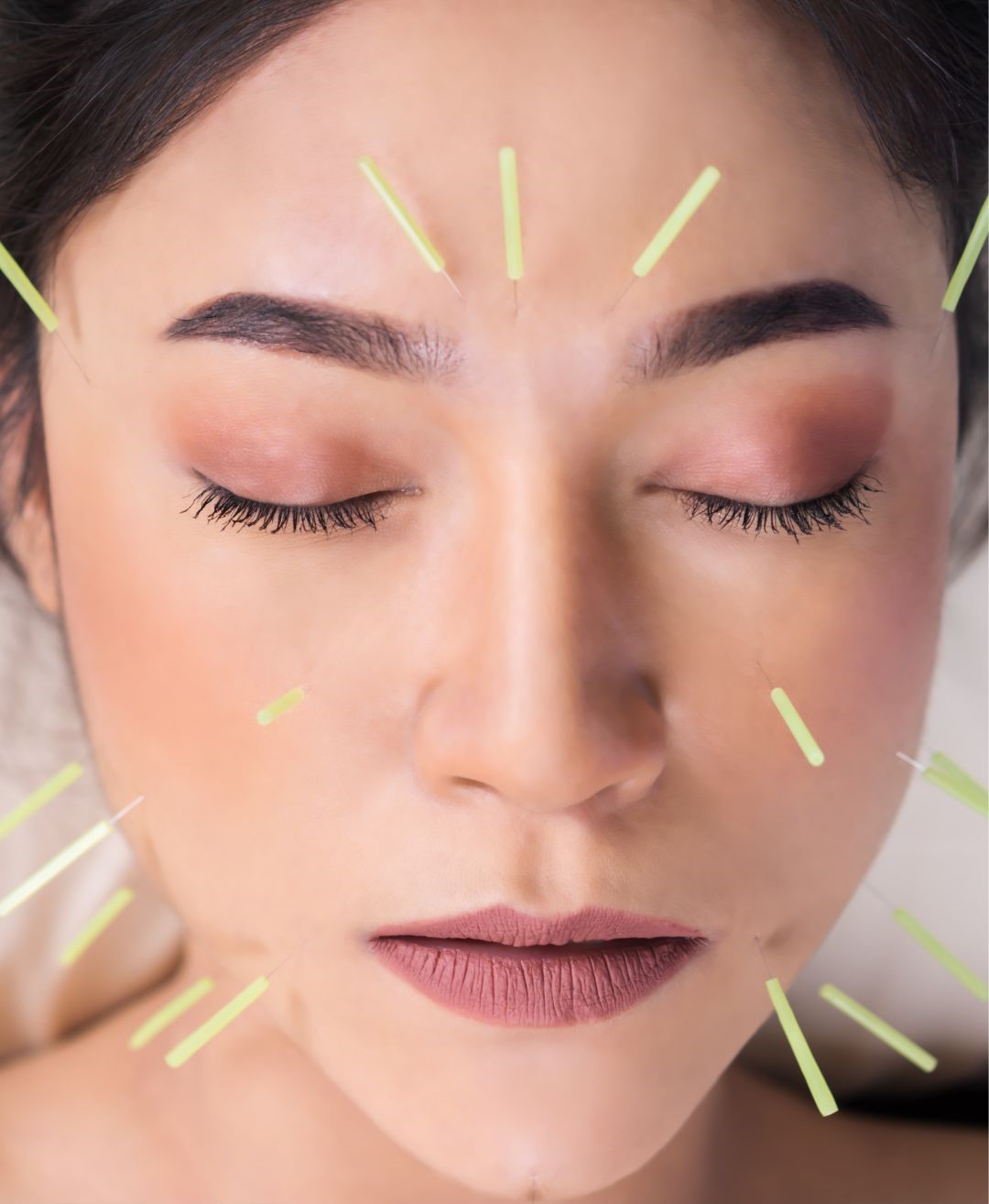 Face Acupuncture