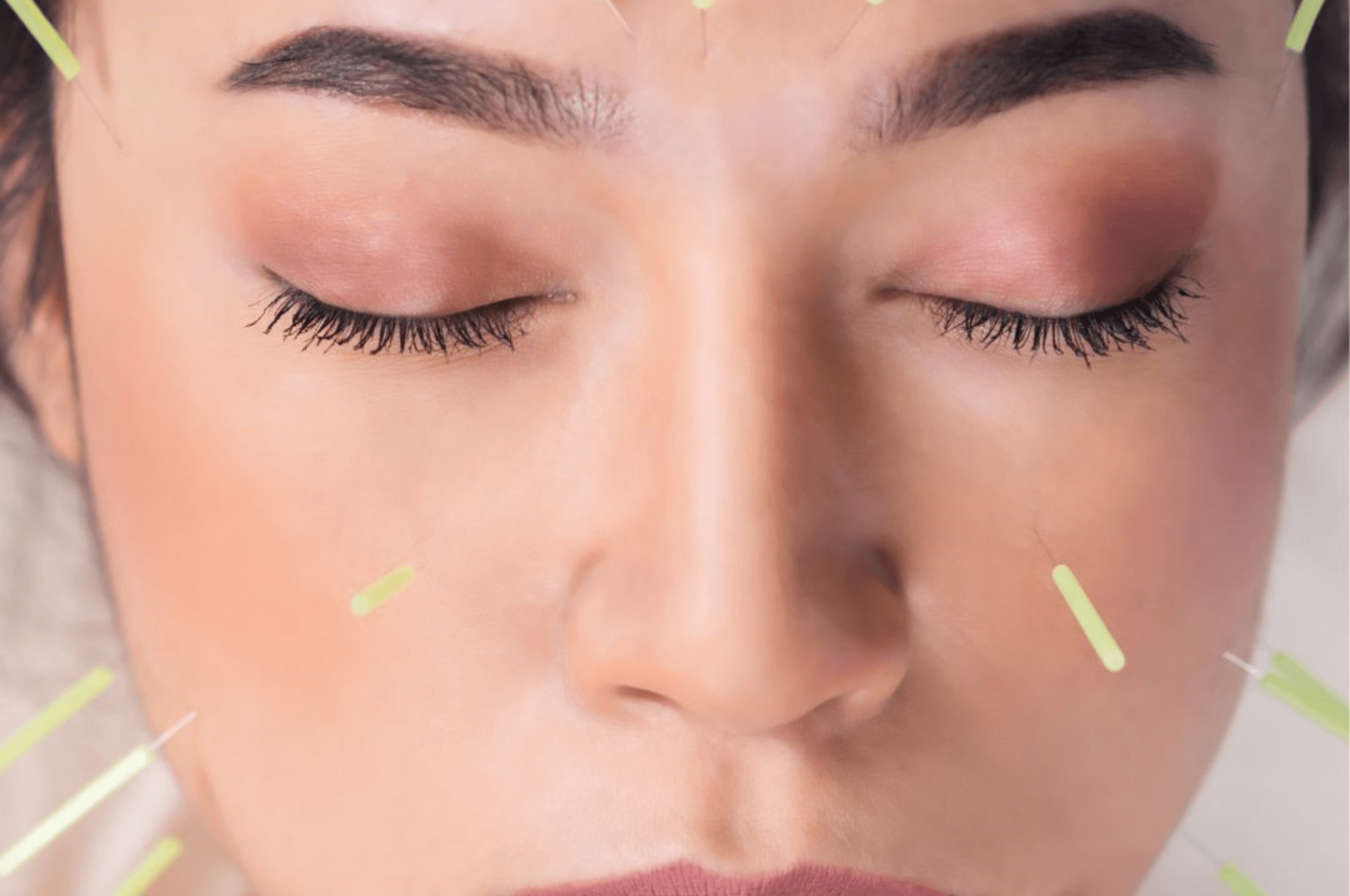 Face Acupuncture