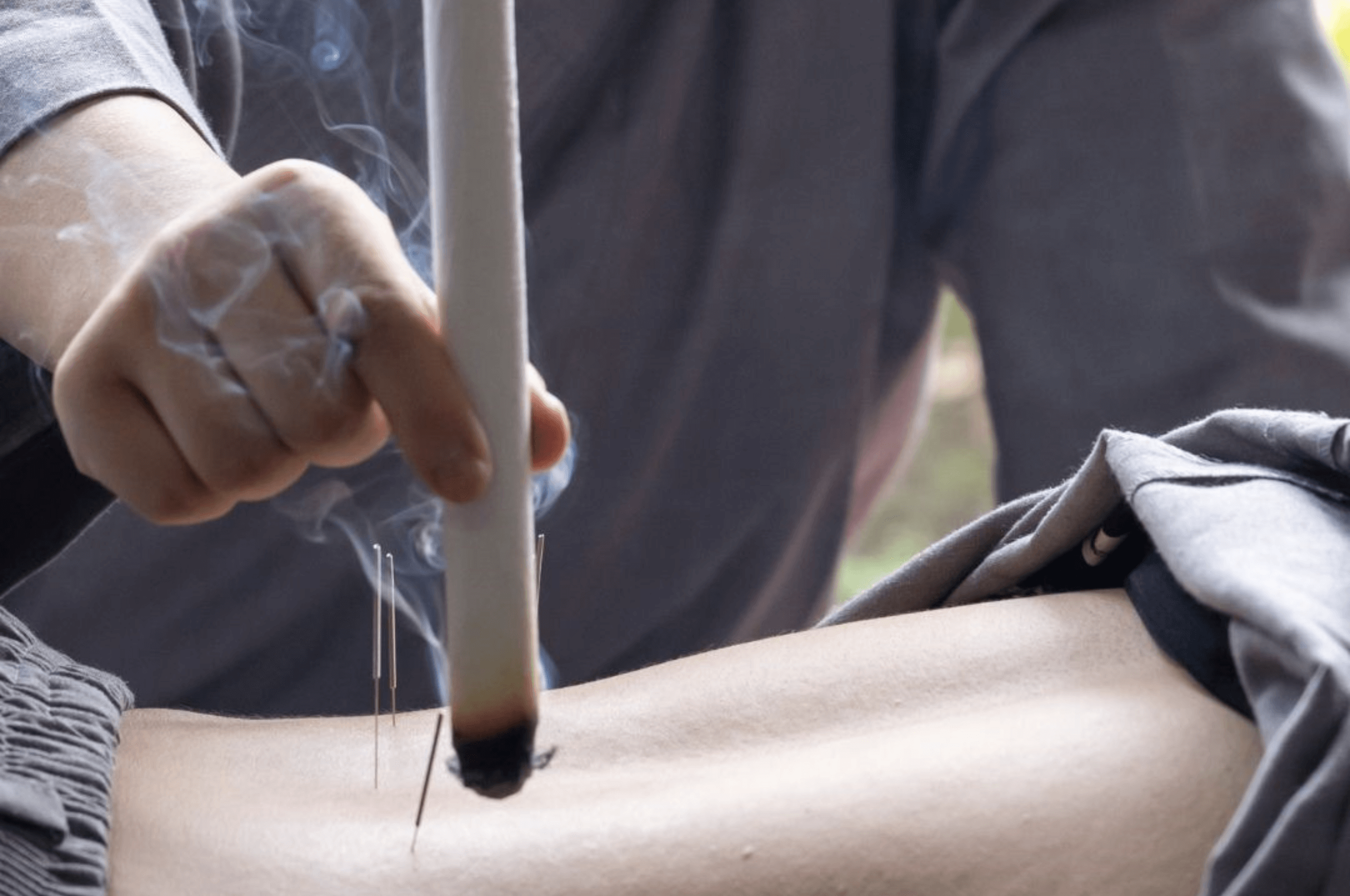 Moxibustion